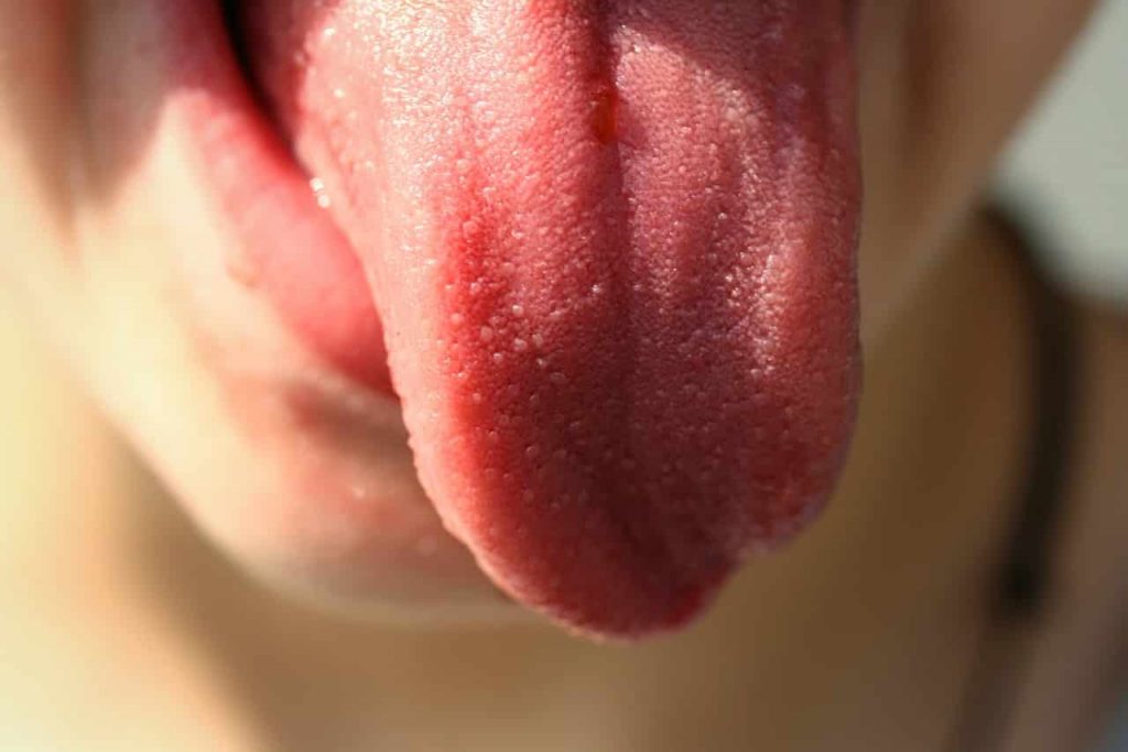 Como curar las llagas de la lengua (11 Consejos para ampollas en la boca)